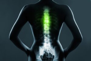 An x-ray image of a spine with the top half glowing in green. 